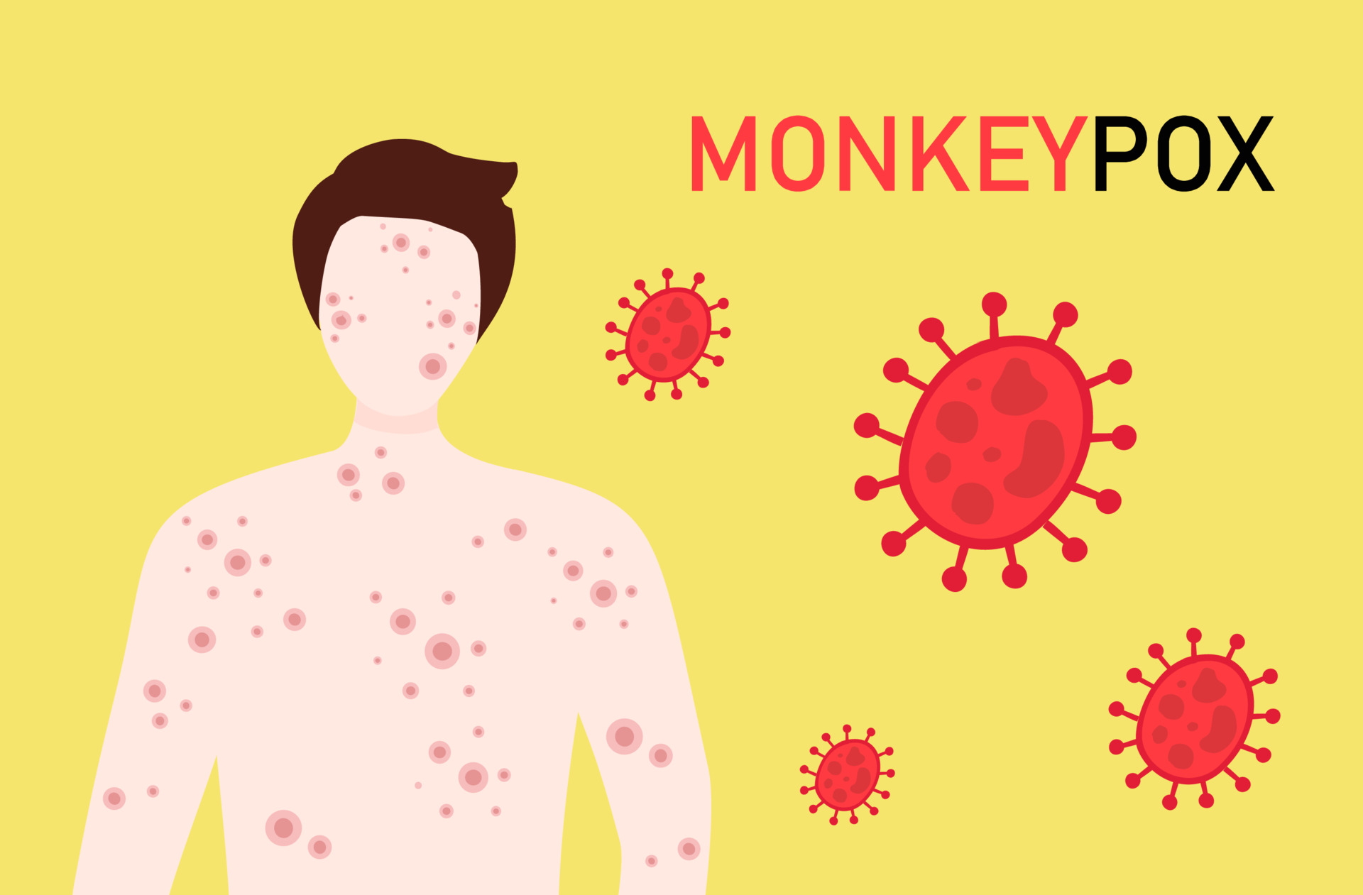 monkeypox, illustration